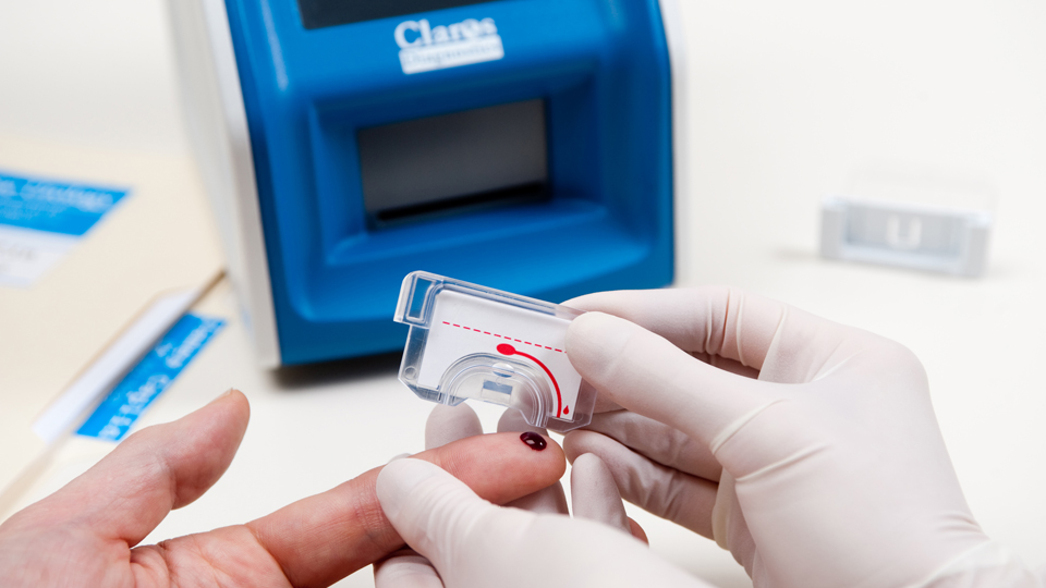 The analyzer allows the urologist to obtain a patient’s PSA from a single drop of blood during a routine office visit.